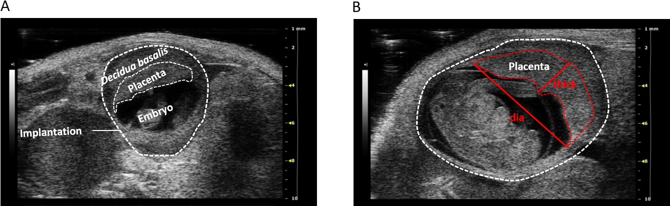 2D grey-scale ultrasound images